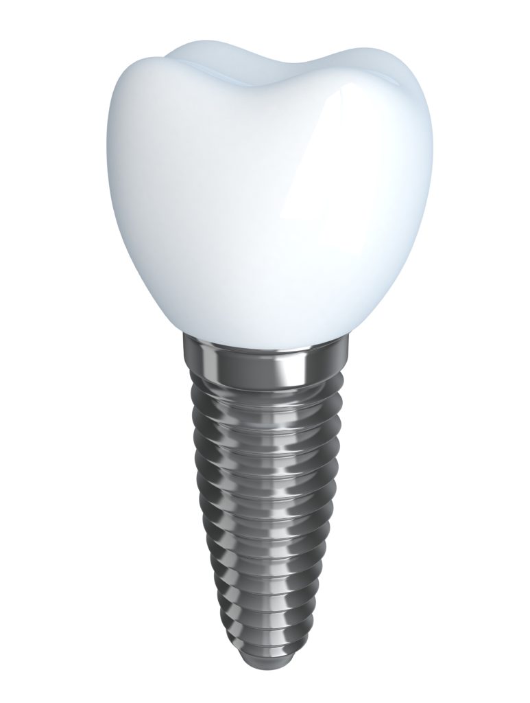 Types of Dental Implants Lerner & Lemongello Cosmetic and