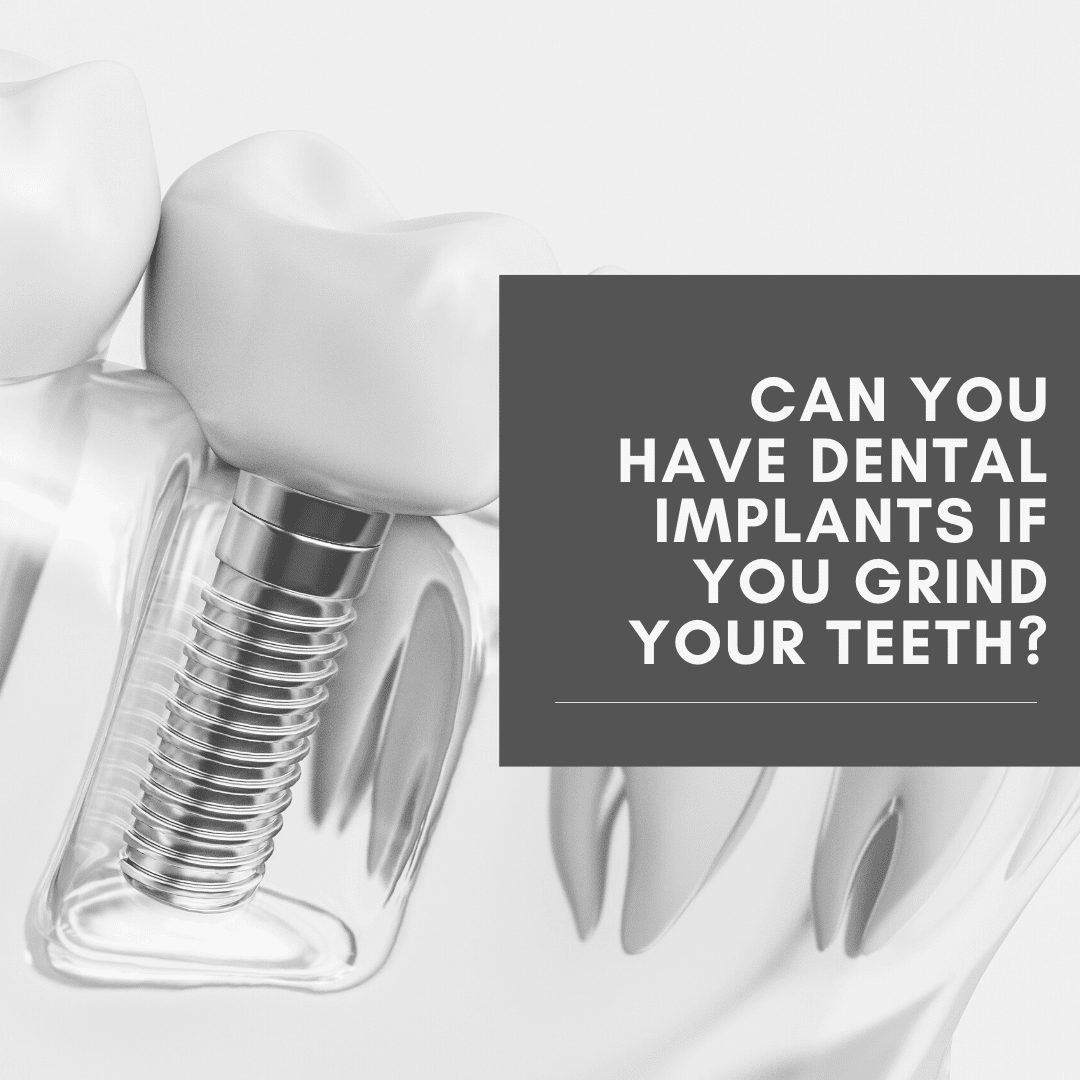 Can you have dental implants if you grind your teeth