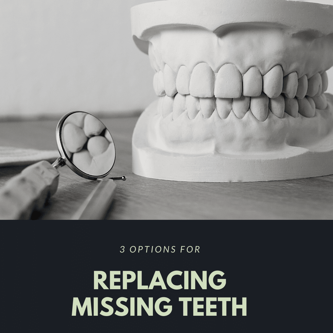 3 Options for Replacing Missing Teeth