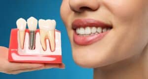 Close up of a smiling woman, with a dentist's hand holding models of dental implants during a consultation